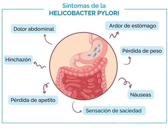 Signos y sintomas helicobacter pylori
